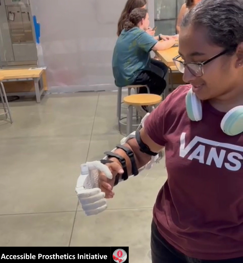 Student grasps arm using 3D printed device